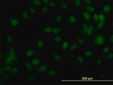 ANTI-TYK2 antibody produced in mouse clone 5A4, purified immunoglobulin, buffered aqueous solution