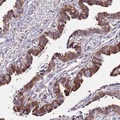 Anti-C19orf24 antibody produced in rabbit Prestige Antibodies&#174; Powered by Atlas Antibodies, affinity isolated antibody, buffered aqueous glycerol solution
