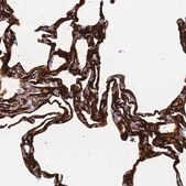 抗-CAV2 兔抗 Prestige Antibodies&#174; Powered by Atlas Antibodies, affinity isolated antibody, buffered aqueous glycerol solution