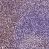 Monoclonal Anti-CD4 antibody produced in mouse Prestige Antibodies&#174; Powered by Atlas Antibodies, clone CL0395, purified immunoglobulin, buffered aqueous glycerol solution