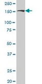 Monoclonal Anti-ROCK2, (C-terminal) antibody produced in mouse clone 1E12, purified immunoglobulin, buffered aqueous solution