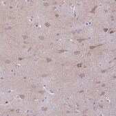 Anti-AHCYL2 antibody produced in rabbit Prestige Antibodies® Powered by Atlas Antibodies, affinity isolated antibody, buffered aqueous glycerol solution