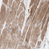 Anti-C2orf40 antibody produced in rabbit Prestige Antibodies&#174; Powered by Atlas Antibodies, affinity isolated antibody, buffered aqueous glycerol solution