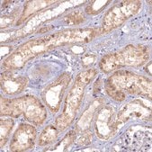 Anti-MICU2 antibody produced in rabbit Prestige Antibodies&#174; Powered by Atlas Antibodies, affinity isolated antibody, buffered aqueous glycerol solution
