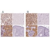 Anti-GALM antibody produced in rabbit Prestige Antibodies&#174; Powered by Atlas Antibodies, affinity isolated antibody, buffered aqueous glycerol solution