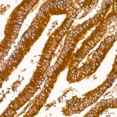 Anti-Clathrin heavy chain Antibody, clone 9M2G2, Rabbit Monoclonal