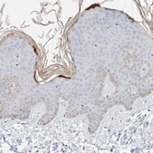 Anti-KPRP antibody produced in rabbit Prestige Antibodies&#174; Powered by Atlas Antibodies, affinity isolated antibody, buffered aqueous glycerol solution