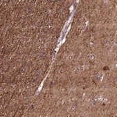 Anti-NAA60 antibody produced in rabbit Prestige Antibodies® Powered by Atlas Antibodies, affinity isolated antibody, buffered aqueous glycerol solution