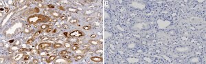 Anti-ZIP14 Antibody, clone 2J18 ZooMAb&#174; Rabbit Monoclonal recombinant, expressed in HEK 293 cells