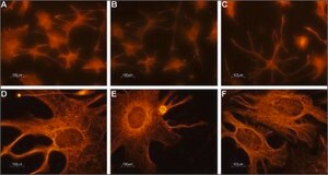 Anti-Cyclic Nucleotide-Gated Cation Channel 2 antibody produced in rabbit affinity isolated antibody, lyophilized powder