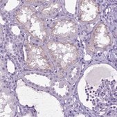 Anti-IGF2 antibody produced in rabbit Prestige Antibodies&#174; Powered by Atlas Antibodies, affinity isolated antibody, buffered aqueous glycerol solution