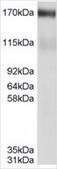 Anti-ABCC4/MRP4 antibody produced in goat affinity isolated antibody, buffered aqueous solution