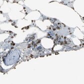 Anti-PSTPIP1 antibody produced in rabbit Prestige Antibodies&#174; Powered by Atlas Antibodies, affinity isolated antibody, buffered aqueous glycerol solution
