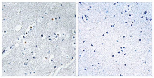 Anti-Histone H2B, N-Terminal antibody produced in rabbit affinity isolated antibody