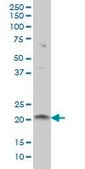 Monoclonal Anti-ITGB3BP antibody produced in mouse clone 3F6, purified immunoglobulin, buffered aqueous solution