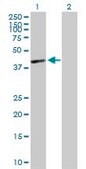 Anti-HLA-C antibody produced in mouse purified immunoglobulin, buffered aqueous solution