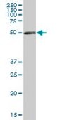 Anti-PDIA3 antibody produced in mouse purified immunoglobulin, buffered aqueous solution