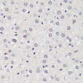 Anti-Phospho-MAPK14-Y182 antibody produced in rabbit