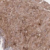 Anti-FBLN1 antibody produced in rabbit Ab1, Prestige Antibodies&#174; Powered by Atlas Antibodies, affinity isolated antibody, buffered aqueous glycerol solution