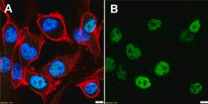 Anti-FOSL1 Antibody, clone 1D10 ZooMAb® Rabbit Monoclonal recombinant, expressed in HEK 293 cells
