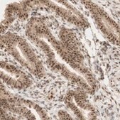Anti-RNF113A antibody produced in rabbit Prestige Antibodies&#174; Powered by Atlas Antibodies, affinity isolated antibody, buffered aqueous glycerol solution