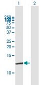 Anti-S100A10 antibody produced in mouse purified immunoglobulin, buffered aqueous solution