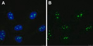 Anti-FTSJ3 Antibody, clone 3F4 ZooMAb® Rabbit Monoclonal recombinant, expressed in HEK 293 cells