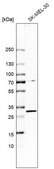 Anti-TP53RK antibody produced in rabbit Prestige Antibodies&#174; Powered by Atlas Antibodies, affinity isolated antibody, buffered aqueous glycerol solution