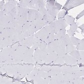 Anti-IL2RB antibody produced in rabbit Prestige Antibodies&#174; Powered by Atlas Antibodies, affinity isolated antibody, buffered aqueous glycerol solution