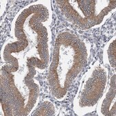 Anti-CLEC16A antibody produced in rabbit Prestige Antibodies® Powered by Atlas Antibodies, affinity isolated antibody, buffered aqueous glycerol solution