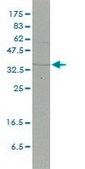 Monoclonal Anti-FHL2 antibody produced in mouse clone 2G3-1A5, purified immunoglobulin, buffered aqueous solution