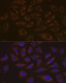 Anti-UBE2C Antibody, clone 5G5L9, Rabbit Monoclonal