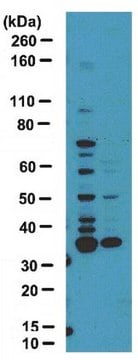 抗-二甲基精氨酸抗体，非对称性（ASYM25） serum, from rabbit
