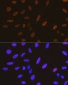 Anti-YAP1 antibody produced in rabbit