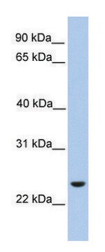 Anti-ORAI1 antibody produced in rabbit affinity isolated antibody