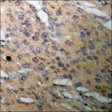 Anti-phospho-CDC6 (pSer54) antibody produced in rabbit affinity isolated antibody