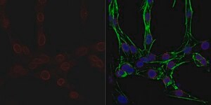 Anti-Nuclear Pore Complex Proteins Antibody, clone 414 clone 414, from mouse