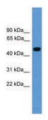 Anti-PSEN1 antibody produced in rabbit affinity isolated antibody
