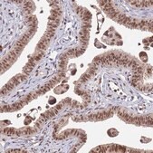 Anti-NCBP2 antibody produced in rabbit Prestige Antibodies® Powered by Atlas Antibodies, affinity isolated antibody, buffered aqueous glycerol solution