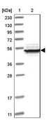 Anti-EIF2B3 antibody produced in rabbit Prestige Antibodies&#174; Powered by Atlas Antibodies, affinity isolated antibody, buffered aqueous glycerol solution, Ab1