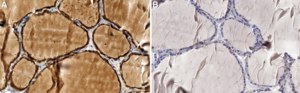 Anti-VEGFA Antibody, clone 1D14 ZooMAb® Rabbit Monoclonal recombinant, expressed in HEK 293 cells