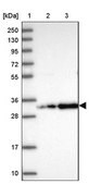 Anti-CCDC127 antibody produced in rabbit Prestige Antibodies&#174; Powered by Atlas Antibodies, affinity isolated antibody, buffered aqueous glycerol solution