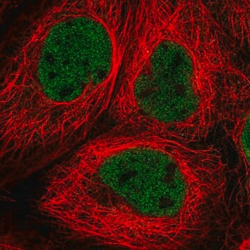 Anti-RNF20 antibody produced in rabbit Prestige Antibodies&#174; Powered by Atlas Antibodies, affinity isolated antibody