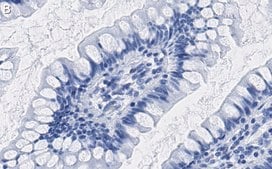 Anti-Interferon &#946; Antibody, clone 4F5 ZooMAb&#174; Rabbit Monoclonal recombinant, expressed in HEK 293 cells