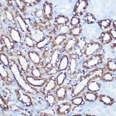 Anti- HK1 antibody produced in rabbit