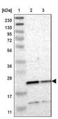 Anti-TMED2 antibody produced in rabbit Prestige Antibodies&#174; Powered by Atlas Antibodies, affinity isolated antibody, buffered aqueous glycerol solution