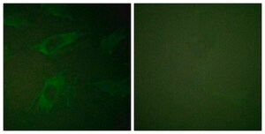 Anti-Rabphilin 3A antibody produced in rabbit affinity isolated antibody