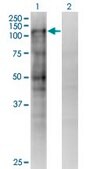 Monoclonal Anti-MSH2 antibody produced in mouse clone 4B2, purified immunoglobulin, buffered aqueous solution