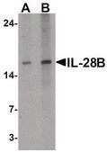 Anti-IL-28B antibody produced in rabbit affinity isolated antibody