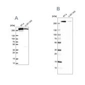 Anti-FASN antibody produced in rabbit Prestige Antibodies&#174; Powered by Atlas Antibodies, affinity isolated antibody, buffered aqueous glycerol solution